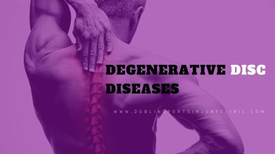 Degenerative Disc Disease (Back Pain)