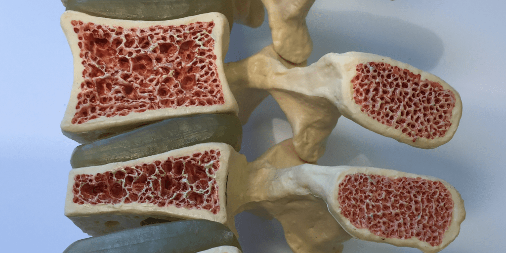 Best exercises for osteoporosis