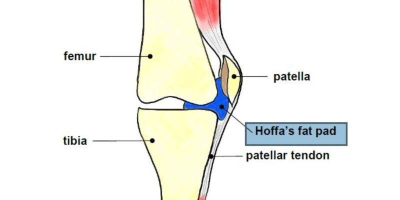 Knee Fat Pad (Hoffa’s Syndrome)